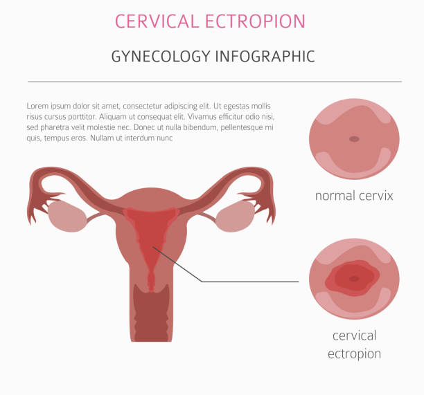 4 Major Causes Of Blood Clots During Menstruation Medicalcaremedia