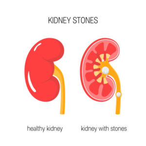 Kidney