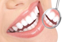 Ways To Whiten Your Teeth 