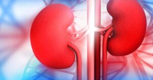 Things That Can Cause Kidney Failure